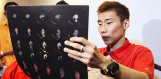 Painful experience: Chong Wei looking at an X-ray image of his torn tendon.