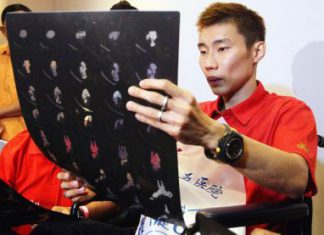 Painful experience: Chong Wei looking at an X-ray image of his torn tendon.