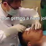 Lin Dan gets a nose job.