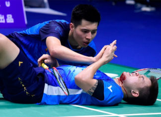 Teo Ee Yi's face is marred by sweat and blood during the 2019 Sudirman Cup quarter-final. (photo: AFP)