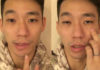 Chan Peng Soon reveals he has Bell's Palsy. (photo: Chan Peng Soon's Facebook)