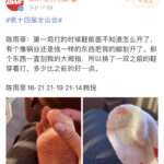 BWF posted Chen Yufei’s right toe injury on its Chinese social media page. (photo: Sina)